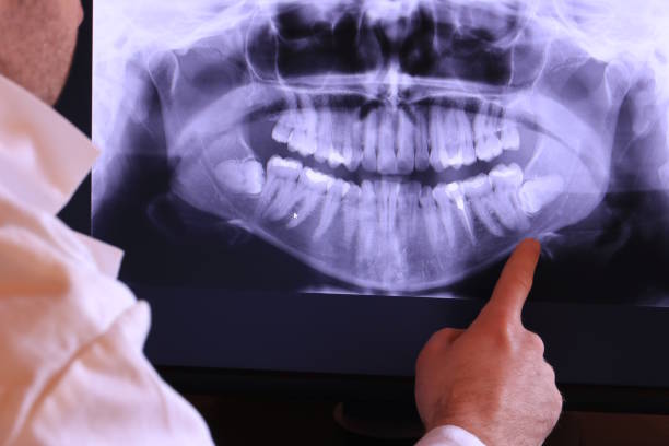 Best Emergency Treatment for Dental Infections or Abscesses in Amador Pines, CA