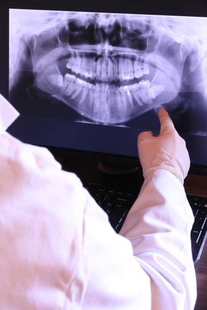 Best Emergency Dental Care for Broken or Chipped Teeth in Amador Pines, CA