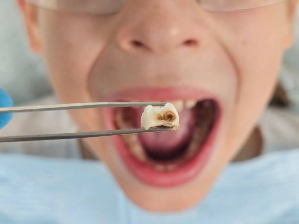 Best Pediatric Emergency Dentist in Amador Pines, CA